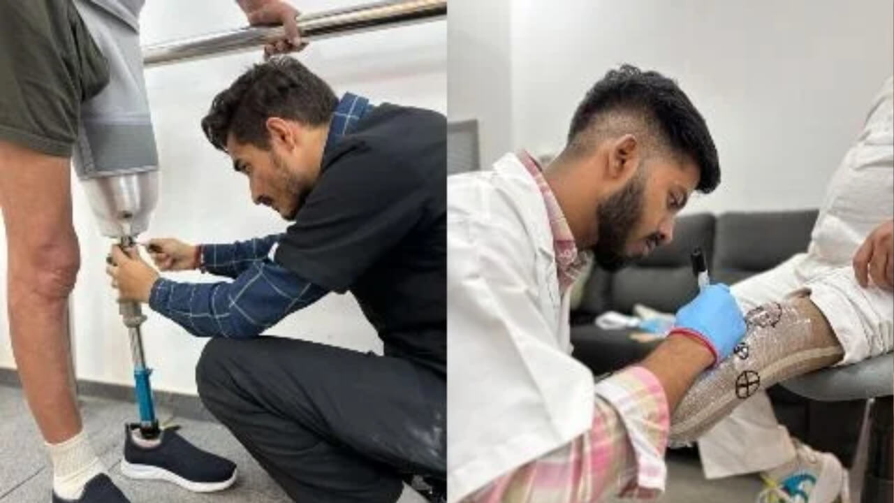 Instalimb fitting 3D printed prosthetics in India. The company will now transfer its technology to partners across the country under the UNIDO program.